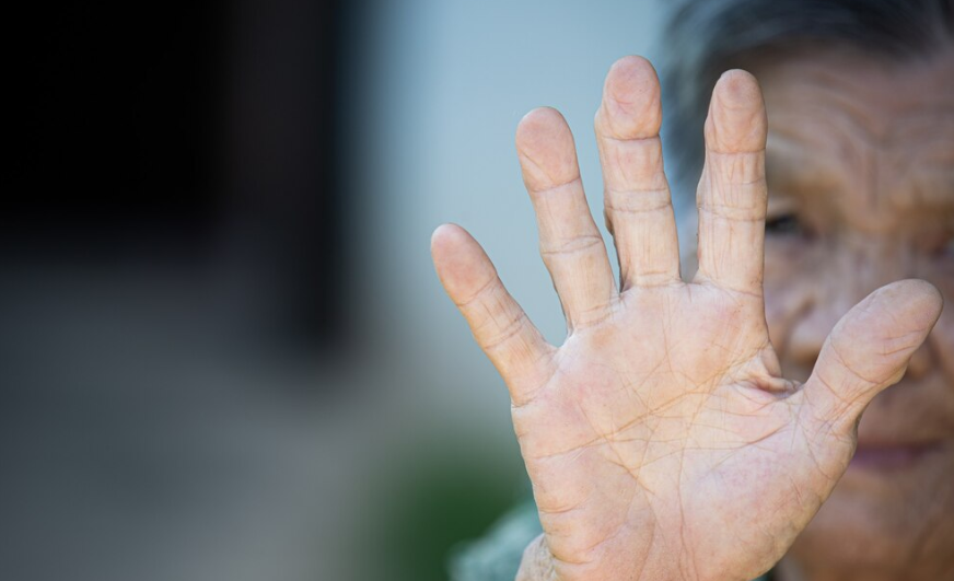 Doença de Parkinson